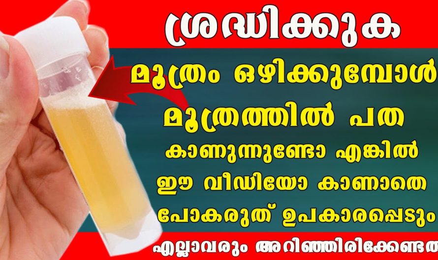 മൂത്രമൊഴിക്കുമ്പോൾ ഇങ്ങനെ കാണപ്പെടാറുണ്ടോ, മൂത്രത്തിൽ പദ കാണുന്നെങ്കിൽ സൂക്ഷിക്കുക.