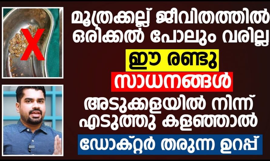 നിങ്ങൾക്കും കിഡ്നി സ്റ്റോൺ ഉണ്ടോ, എങ്ങനെ ഇതിനെ പെട്ടെന്ന് ഭേദമാക്കാം.