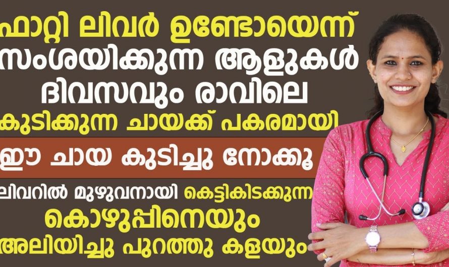 ഏത് സ്റ്റേജിൽ എത്തിയ ഫാറ്റി ലിവറിനെയും ഇനി മറികടക്കാം.