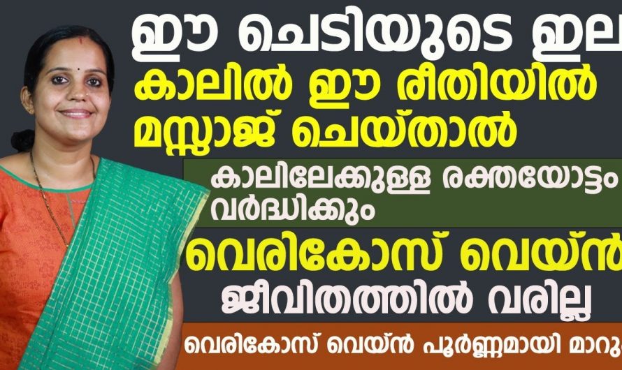 വെരിക്കോസ് പ്രശ്നങ്ങളെ ഇനി വെളുത്തുള്ളി നോക്കിക്കോളും.