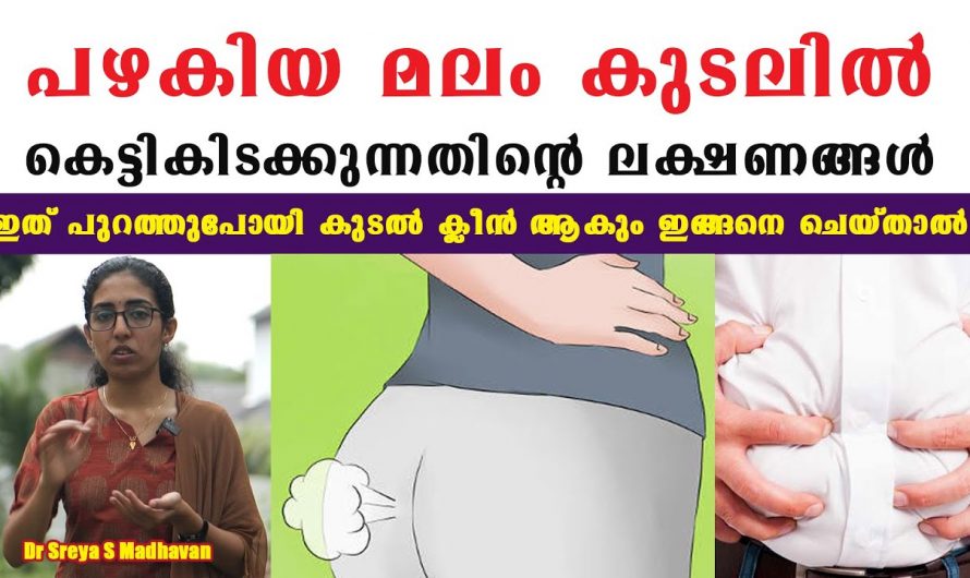 കുടലിൽ കെട്ടിക്കിടക്കുന്ന മലം മുഴുവൻ പുറത്തുപോകും.