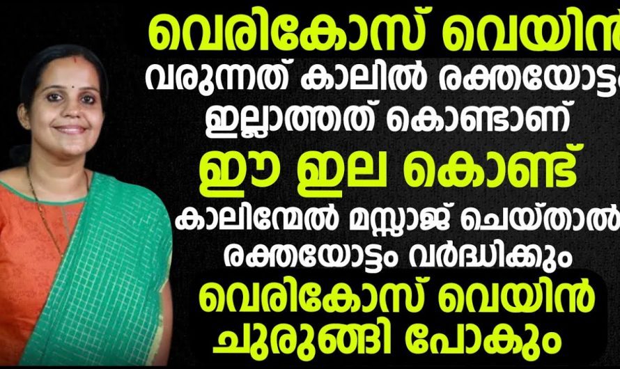 മൂന്ന് തലയണ മതി ഏത് വലിയ വെരിക്കോസും കീഴടങ്ങും.