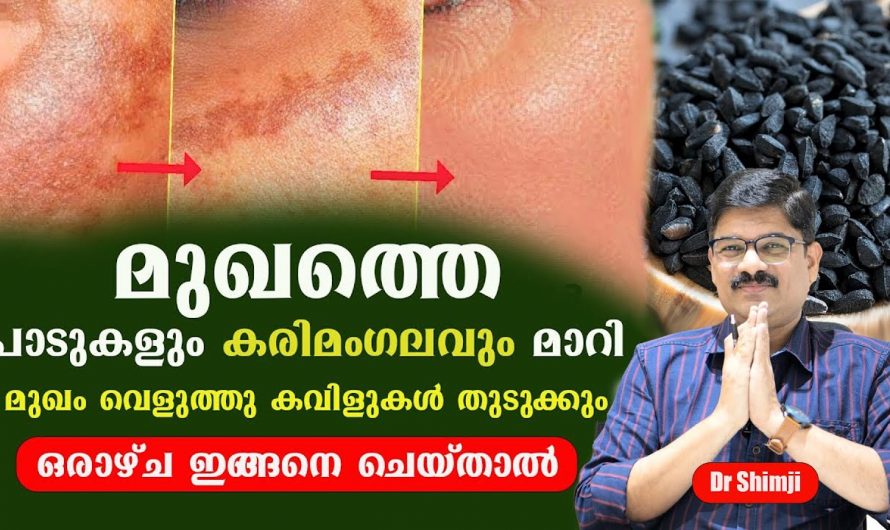 നിങ്ങളുടെ ചർമം ഇനി വെട്ടിത്തിളങ്ങും. കുരുക്കളും പാടുകളും മാറി മുഖ സൗന്ദര്യം ഇരട്ടിയാകും.