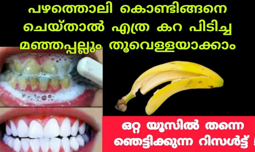 ഇതൊന്നു പരീക്ഷിച്ചു നോക്കൂ നിങ്ങളുടെ പല്ലുകൾ വെട്ടി തിളങ്ങും.