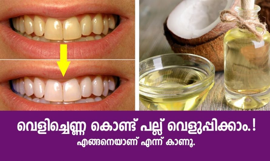 വെളിച്ചെണ്ണ കൊണ്ട് പല്ലു തേയ്ക്കാം, അതിശയിപ്പിക്കുന്ന ഈ കാര്യം ഒന്ന് ചെയ്തു നോക്കൂ.