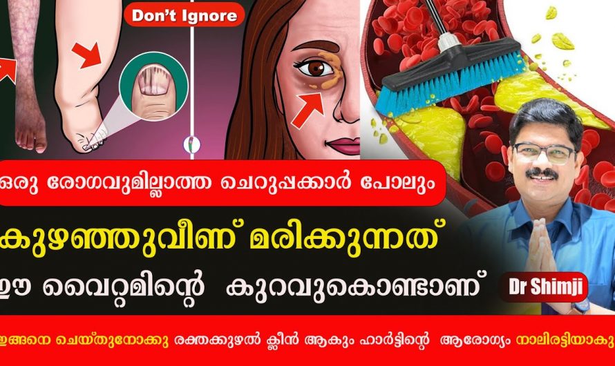 നിന്ന നിൽപ്പിൽ കുഴഞ്ഞുവീണ്  മരിക്കുന്നതിന് ഇതും ഒരു കാരണമാണ്
