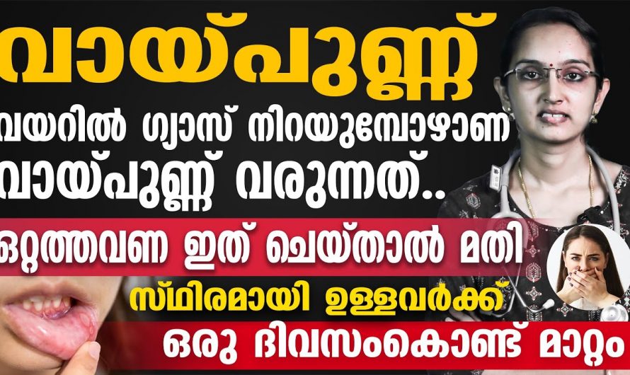 ഈ ഇല തിളപ്പിച്ച വെള്ളം  കവിൾ കൊണ്ടാൽ മതി എത്ര വലിയ വായ് പുണ്ണും മാറും