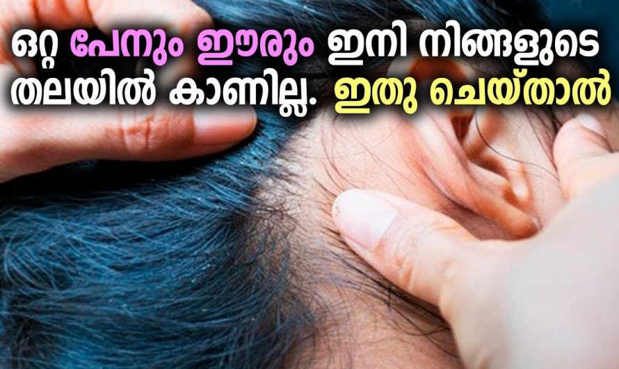 ഒരു പേൻ പോലും അവശേഷിക്കാതെ നിങ്ങളുടെ തല വൃത്തിയാക്കാം