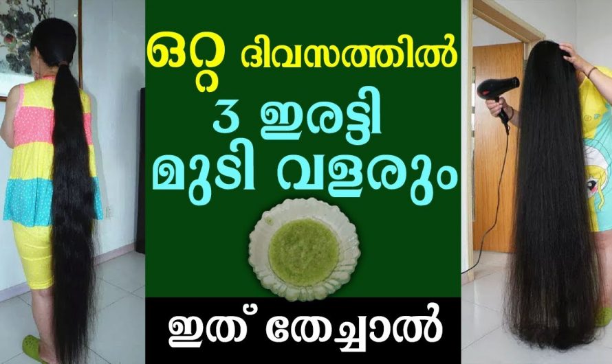 മുടിയുടെ വളർച്ചയിലുള്ള ഇത്തരം ഒരു അത്ഭുത പ്രതിഭാസം നിങ്ങൾ ഇതുവരെ കണ്ടിട്ടുണ്ടാകില്ല.