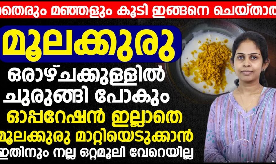 സർജറി ഇല്ലാതെ മൂലക്കുരു ഇല്ലാതാക്കാൻ ഈ മാർഗം ഇനി പരീക്ഷിക്കാം