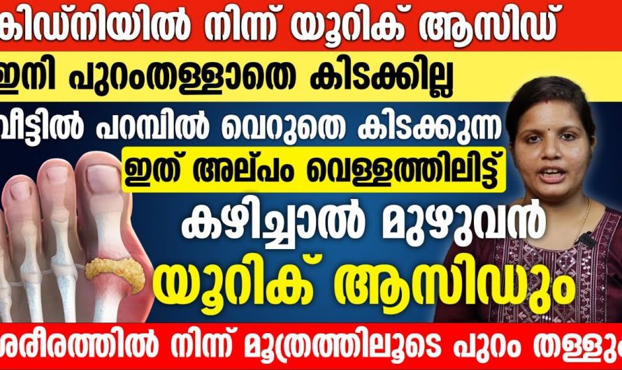 യൂറിക്കാസിഡ് കുറയ്ക്കാൻ ഇങ്ങനെയൊരു മാർഗം ഇത് ആദ്യം