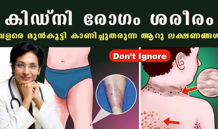 സൂക്ഷിച്ചില്ലെങ്കിൽ ഉടനെ മരണം പോലും സംഭവിക്കാം, നിങ്ങളുടെ കിഡ്നി തകരാറിലാണ്