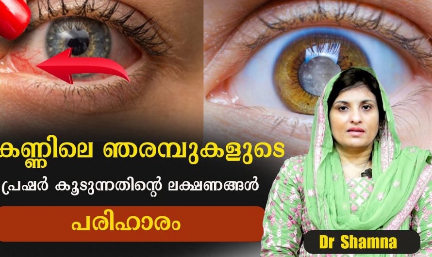 കണ്ടില്ലെന്ന് നടിക്കേണ്ട കാഴ്ചമങ്ങുന്നതിന്റെ ലക്ഷണമാണിത്