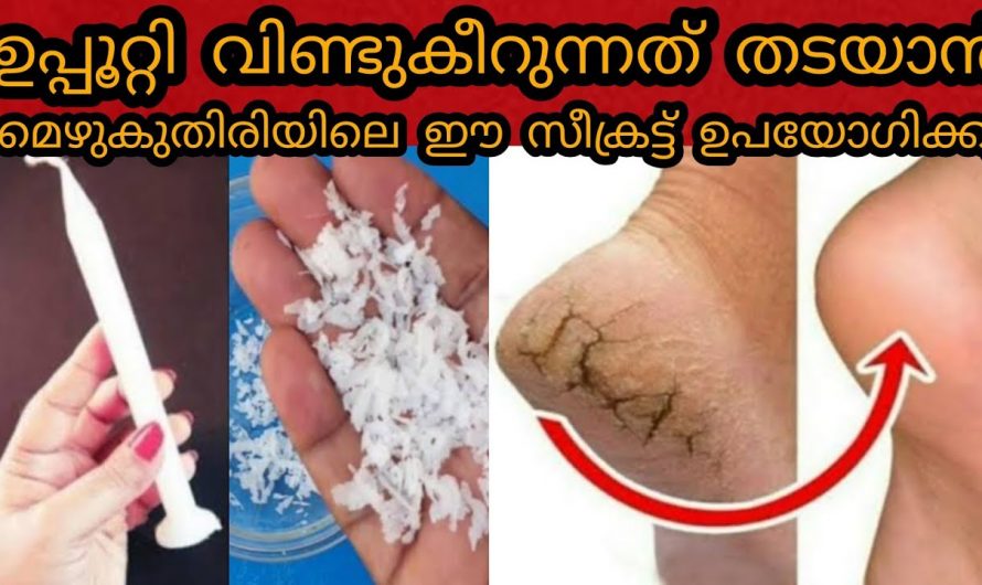 വിണ്ടുകീറിയ കാലുകളെ എന്നെന്നേക്കുമായി  മനോഹരമാക്കാൻ ഇത് ഉപയോഗിക്കാം