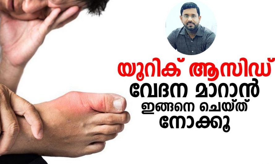 നിങ്ങളുടെ പ്രശ്നം യൂറിക്കാസിഡ് ആണോ എങ്കിൽ ഇത് മാറ്റാൻ എളുപ്പവഴി ഉണ്ട്