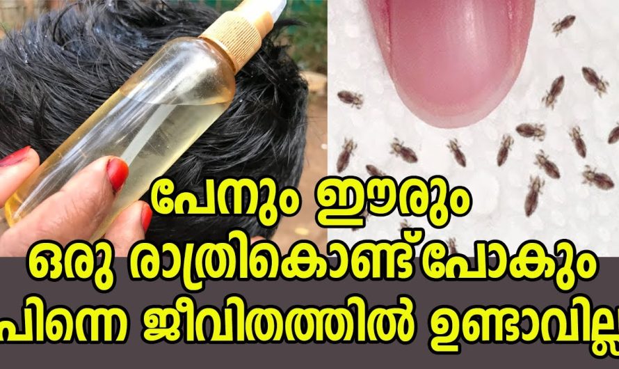 ഒരു ഒറ്റരാത്രികൊണ്ട് എത്ര മുഴുത്ത പേനും ഇറങ്ങിയോടും